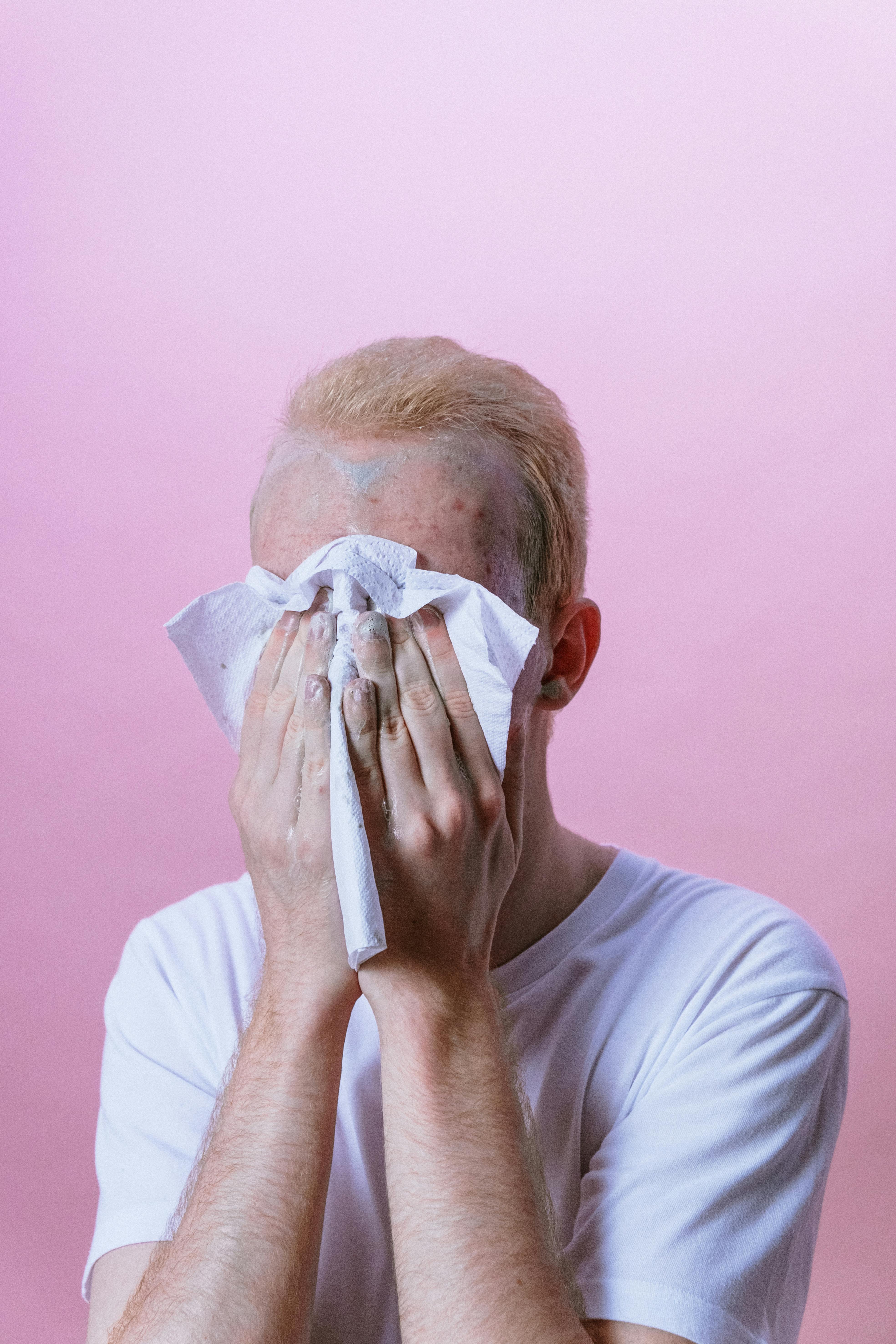 joven con acné secando su rostro con una toalla de papel desechable.